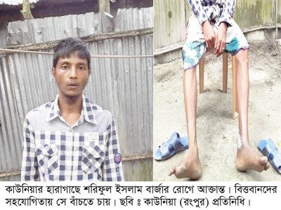 দুটি পা বার্জার রোগে নষ্ট হওয়ার পথে, সমাজের বিত্তবানরাই পারে শরিফুলকে বাঁচাতে 
